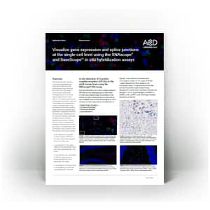 Visualize gene expression and splice junctions at the single-cell level using the RNAscope and BaseScope™ in situ hybridization assays