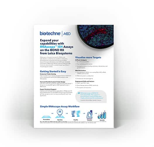 RNAscope Automated LS Assay - Expand your capabilities with RNAscope ISH Assays on the BOND RX from Leica biosystems