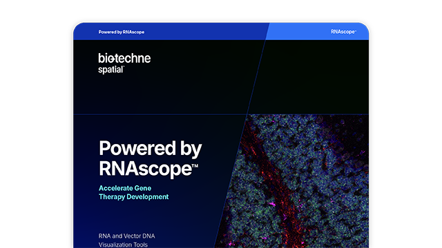 RNAscope Accelerate Gene Therapy Development Card