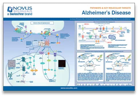 Alzheimer's Disease Poster Request