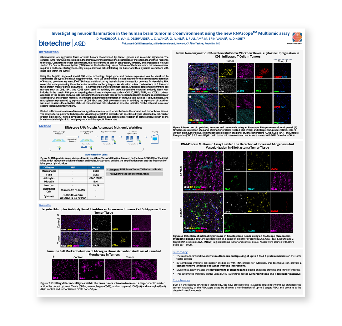 Investigating Neuroinflammation in the Human Brain