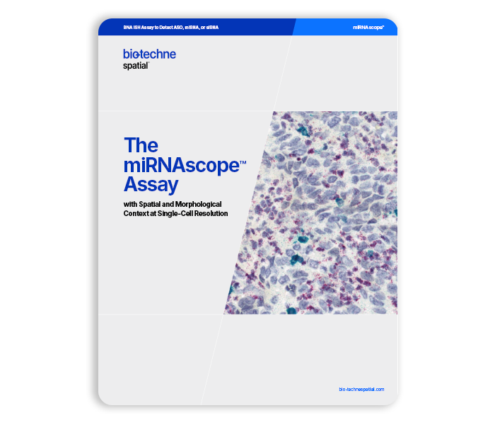 miRNAscope Assay Brochure Thumbnail