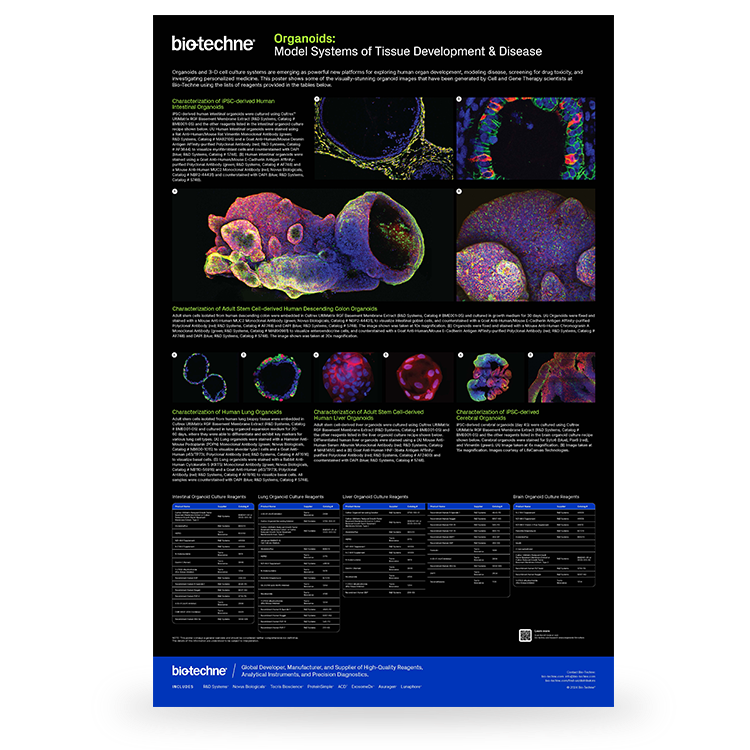 Organoids: Model Systems of Tissue Development and Disease Poster