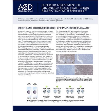 Thmbnail image of Superior assessment of Ig light chain with RNAscope flyer