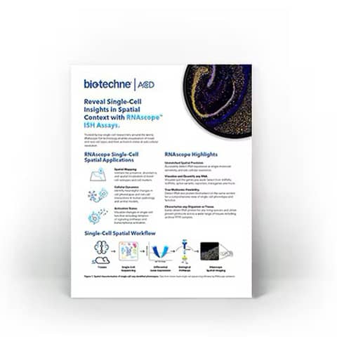 Image of RNAscope single cell analysis in spatial context flyer 