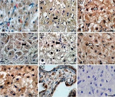 HIF 1 alpha antibody