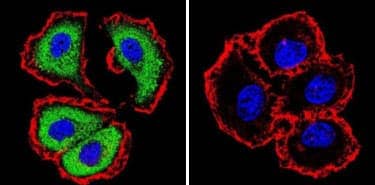 ICC/IF analysis of NFATc1 in MCF7 cells