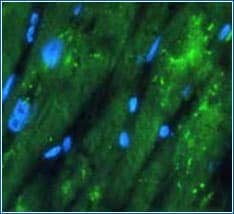 Example of Fixative-induced Autofluorescence