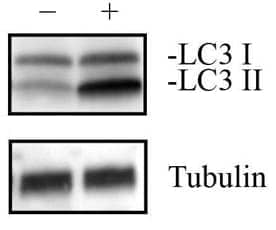 lc31 Tubulin