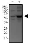 tubulinTM1b