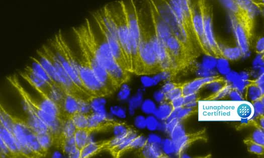 Detection of EPCAM in Mouse Colon Data Image