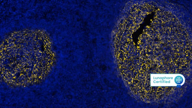 Detection of CD21 in Human Lymph Node via seqIF™ staining on COMET™