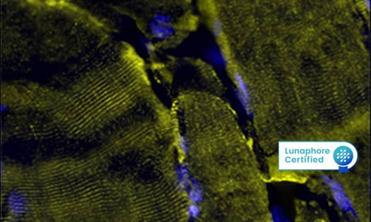 Detection of Desmin in Human Skeletal Muscle via seqIF™  Data Image