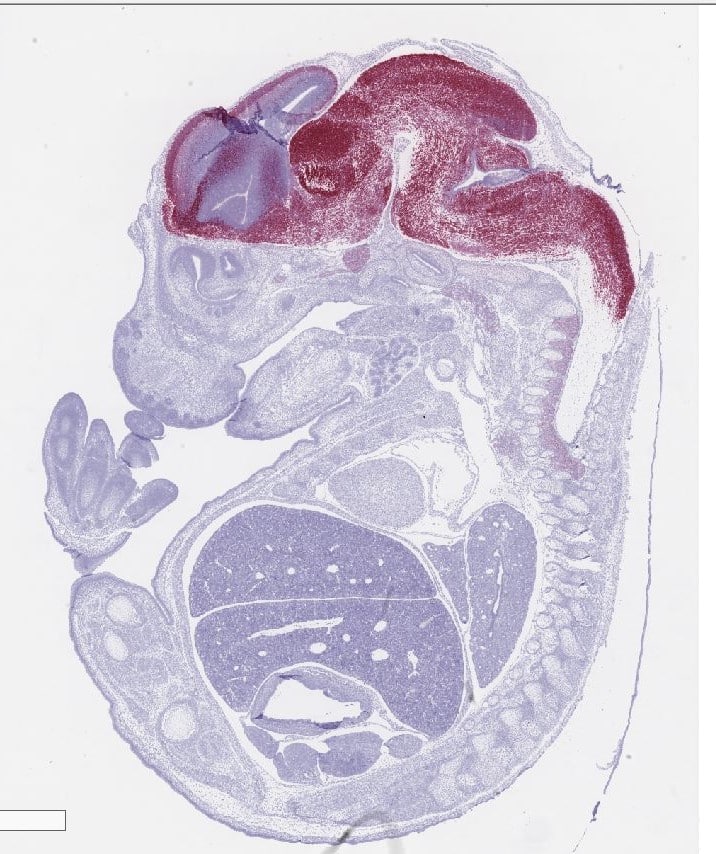 ACD miRNAscope image - Mouse Embryo