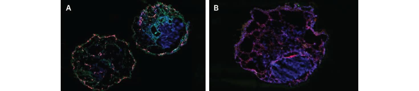 Two panels of fluorescently-stained images of iPSC-derived human heart organoids.