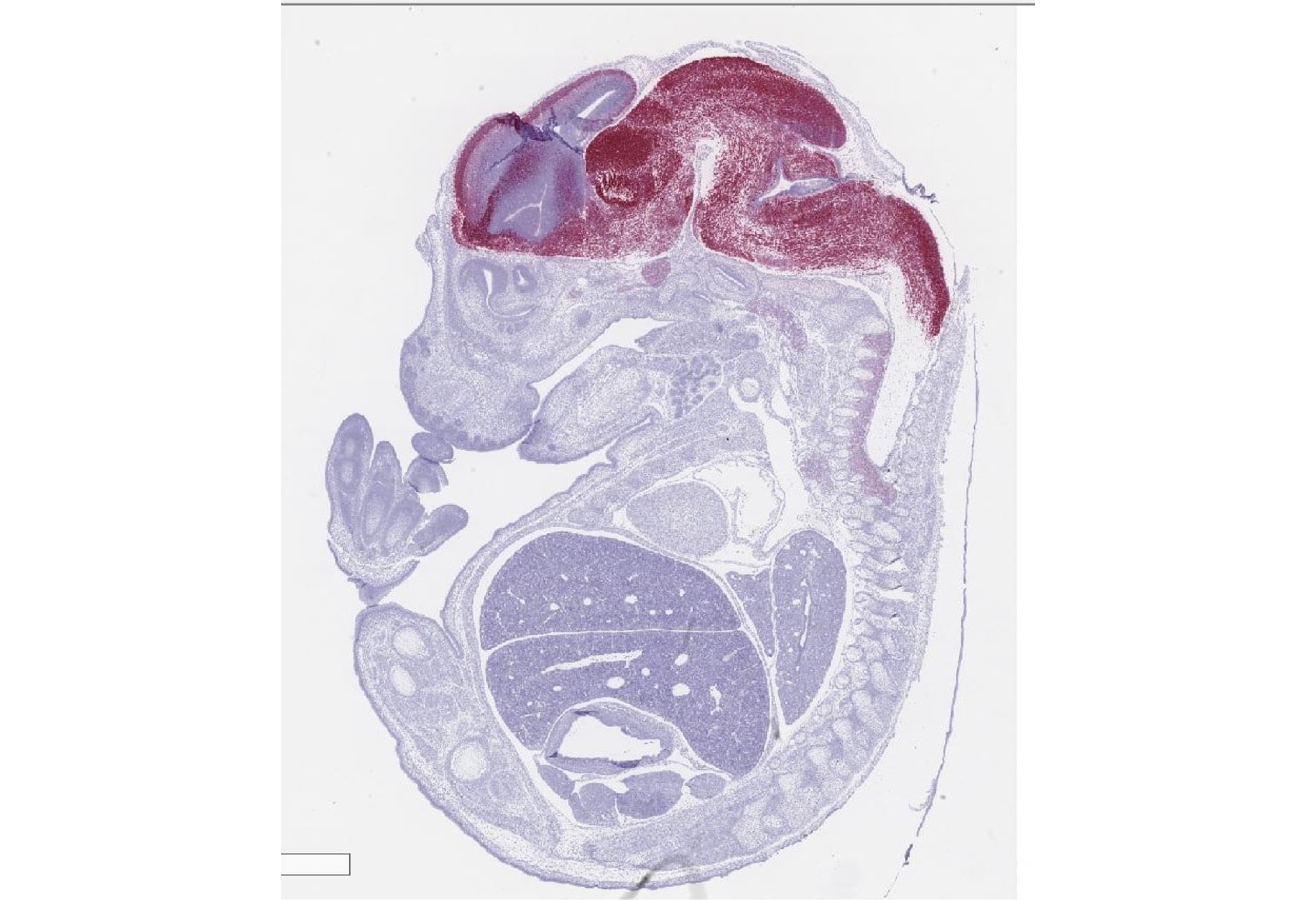 ACD miRNAscope image - Mouse Embryo