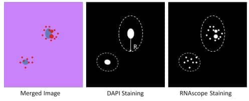 Figure 4. Counting the number of signal dots within one cell