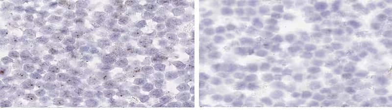 RNAscope images showing HeLa cells with cytoplasmic background and clear background  and 