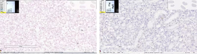 RNAscope images of kidney tissue showing nuclear background and clean background 