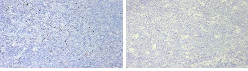 RNAscope images showing human tonsil tissue with nuclear hazy background and clear background  and 