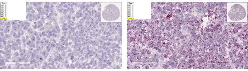 RNAscope staining patterns showing xenograft tissue with optimal digestion