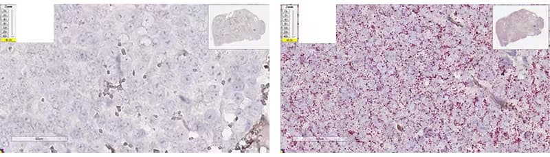 RNAscope staining patterns showing over-digested xenograft tissue