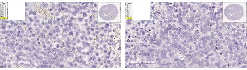 Rnascope troubleshooting xenograft tissue under-digested