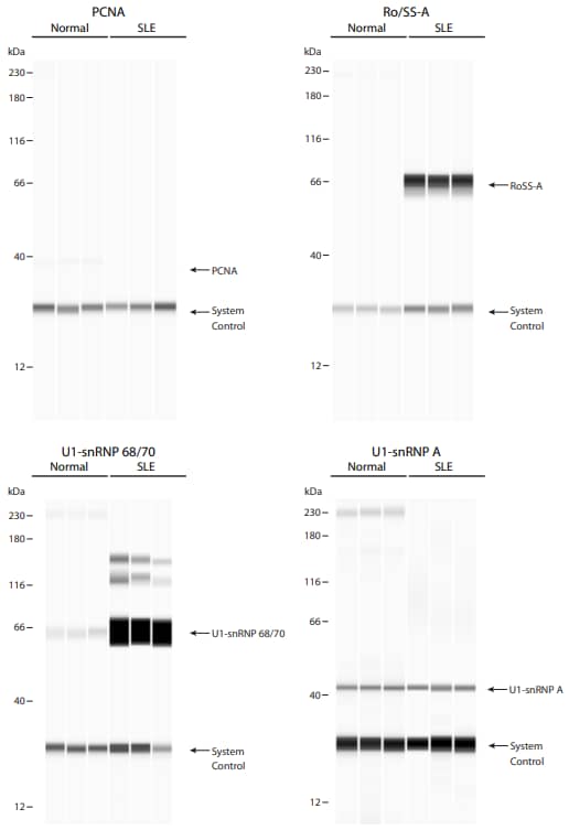 Diluted normal and SLE patient serum samples