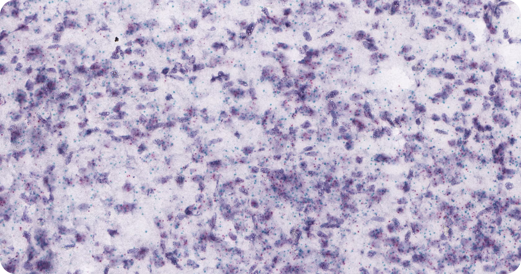 basescope assay p10-digap1-e9-10-e9-7