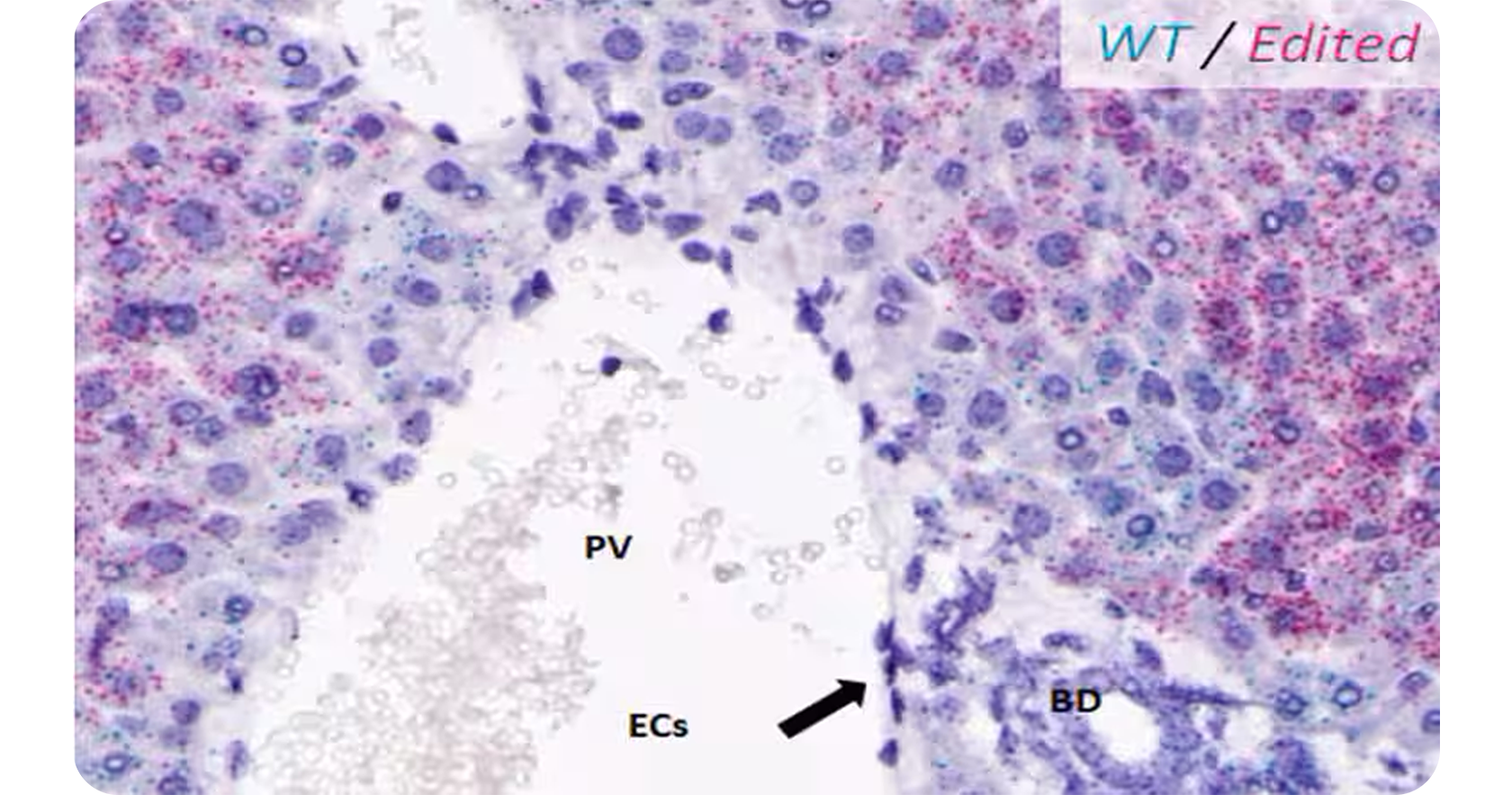 basescope chromogenic duplex assay