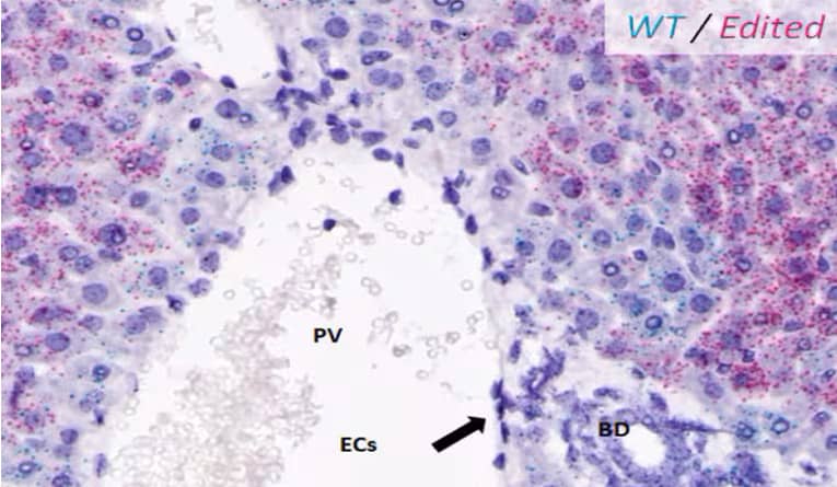 BaseScope Chromogenic duplex assay 