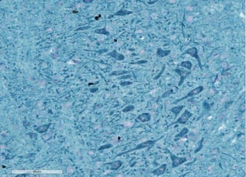 BaseScope single plex chromogenic assay