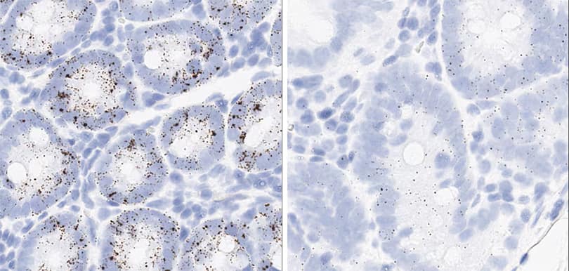 RNAscope image showing proliferation and apoptosis markers in monkey duodenum