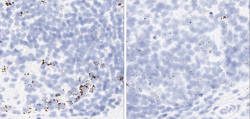 RNascope image showing Proliferation and apoptosis markers in monkey tonsil