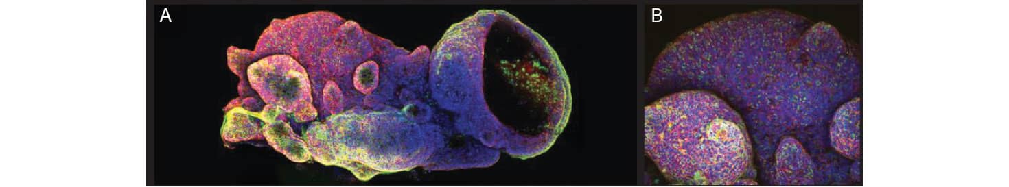 Two panels of fluorescently-stained images of adult stem cell-derived human descending colon organoids.