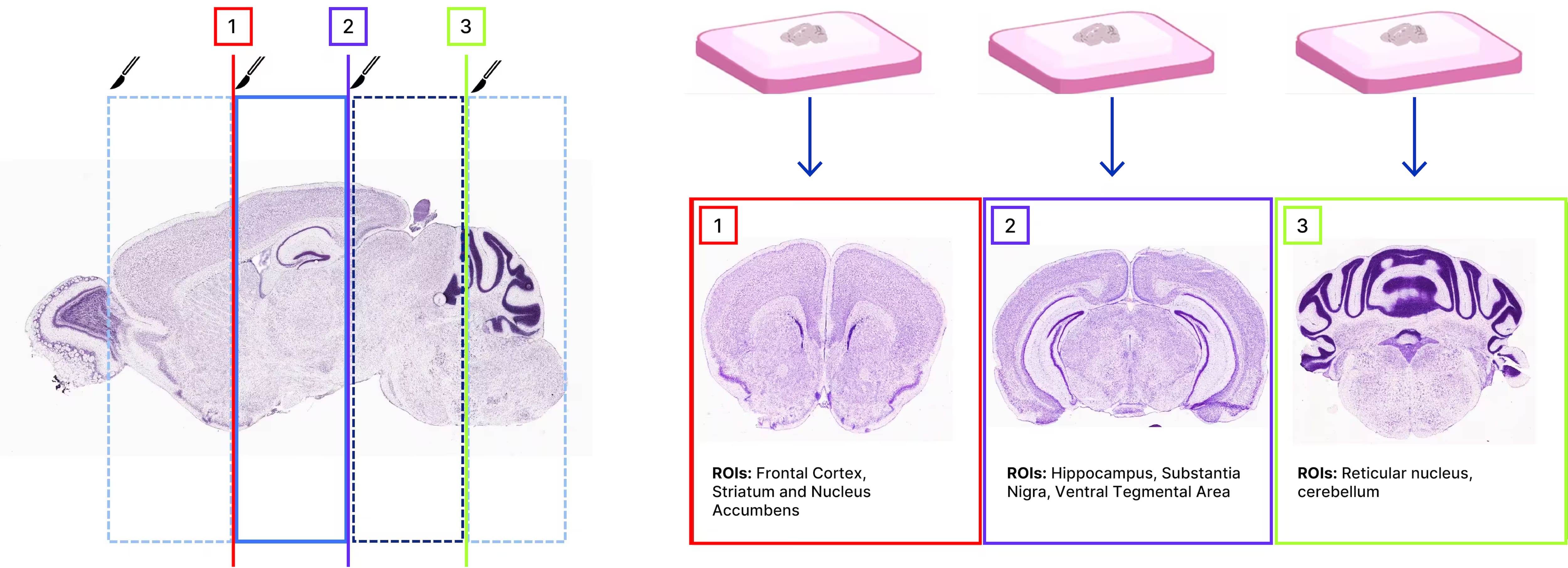 RNAscope for ROI Analysis in Neuroscience | Bio-Techne Spatial