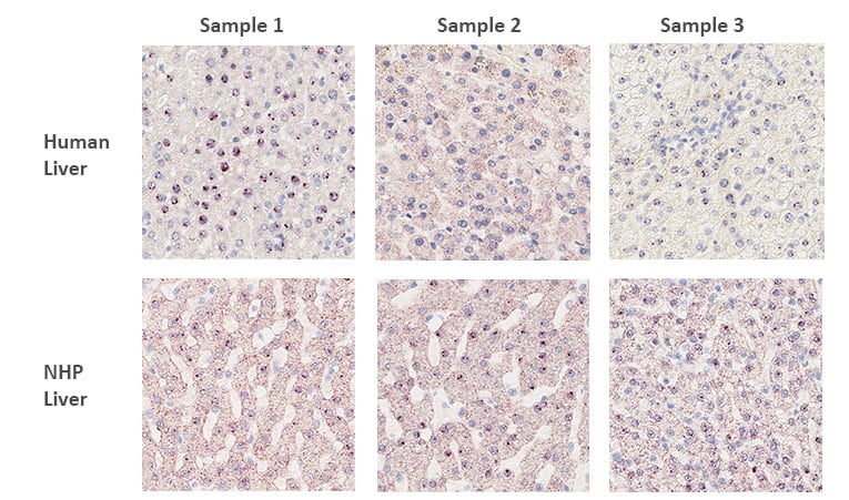 RNAscope single-plex assay highlighting expression of a gene involved in fatty acid production in multiple liver samples