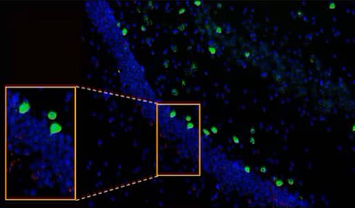 Cnr1 (green) and Drd1 (red) expression in the hippocampus of normal mouse brain using the RNAscope Multiplex Fluorescent Assay