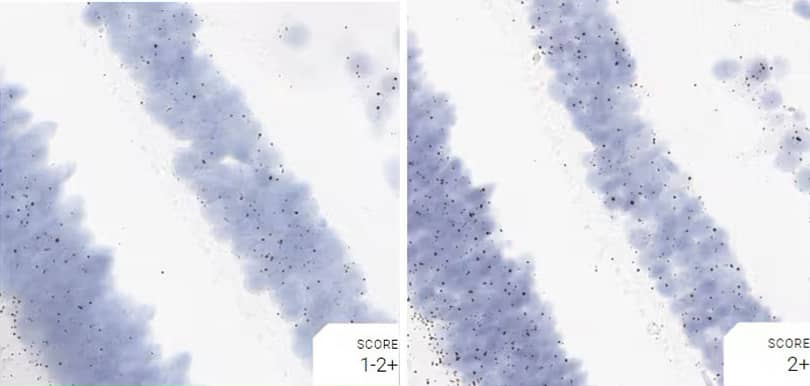 RNAscope images comparing pretreatment conditions using positive control probe Hs-polr2a in monkey retina