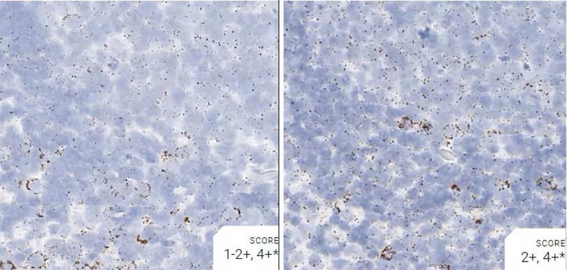 Comparison of pretreatment conditions for rat lymph node tissue using RNAscope assays