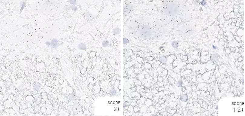 Comparison of pretreatment conditions for rat spinal tissue using RNAscope assays