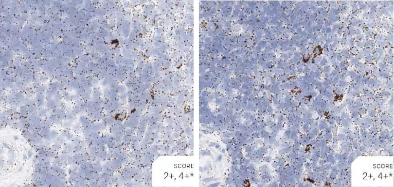 Comparison of pretreatment conditions for rat spleen tissue using RNAscope assays