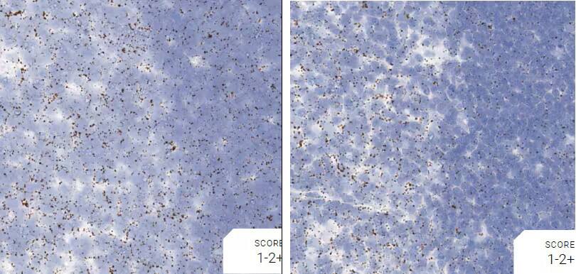 Comparison of pretreatment conditions for rat thymus tissue using RNAscope assays