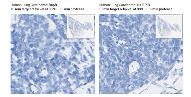 RNAscope assay image highlight issue of under-digested tissue