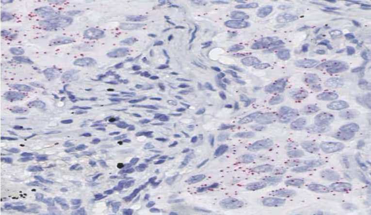 Automated RNAscope assay on Roche Discovery Ultra image showing lung tissue