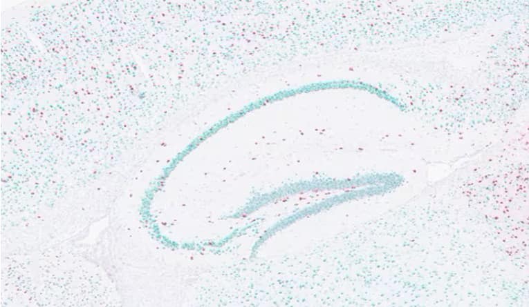 Automated RNAscope assay on Roche Discover Ultra image showing mouse brain tissue