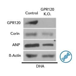 Novus Biologicals GPCR antibodies are extensively validated using the 5 Pillars of Antibody Validation.