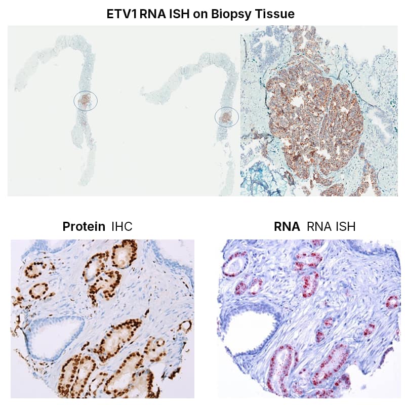 RNA ISH images