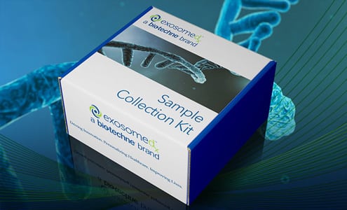 Bio-Techne offers individuals an COVID-19 detection test with an at-home sample collection kit.