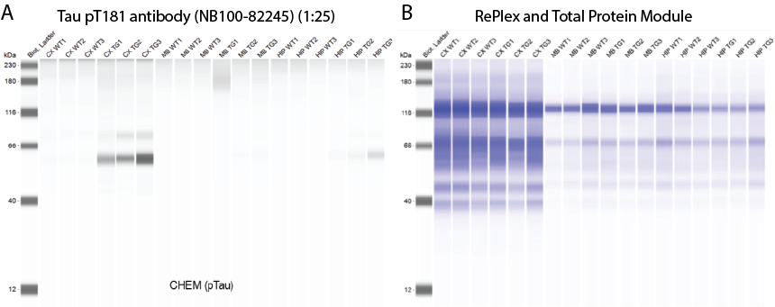 Biomarker phospho-Tau Figure